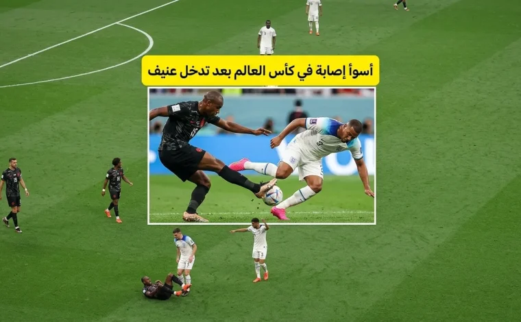 اسوأ اصابة في تاريخ كرة القدم
